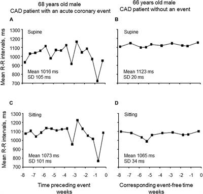 Home Monitoring of Heart Rate as a Predictor of Imminent Cardiovascular Events